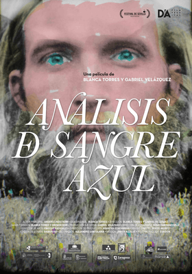 Análisis de sangre azul Análisis de sangre azul